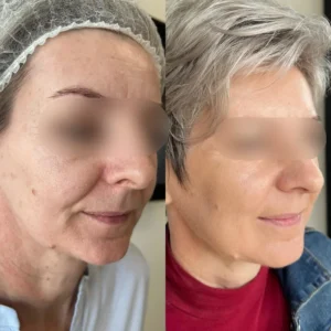 Stymulatory tkankowe