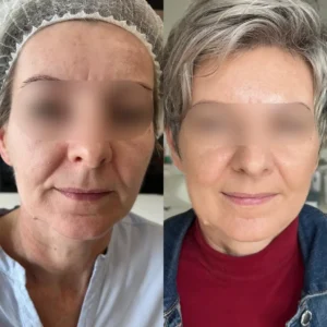 Stymulatory tkankowe