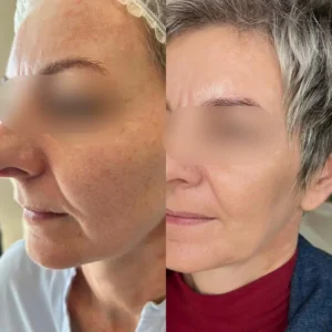 Stymulatory tkankowe