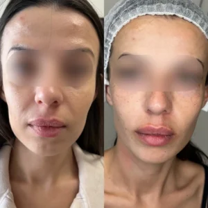 Stymulatory tkankowe