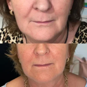 Stymulatory tkankowe