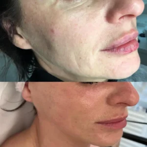 Stymulatory tkankowe