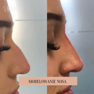 Modelowanie nosa