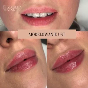 Modelowanie ust